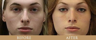 Dr. Gregory Chernoff Before and After