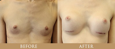 Dr. Gregory Chernoff Before and After
