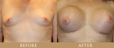 Dr. Gregory Chernoff Before and After