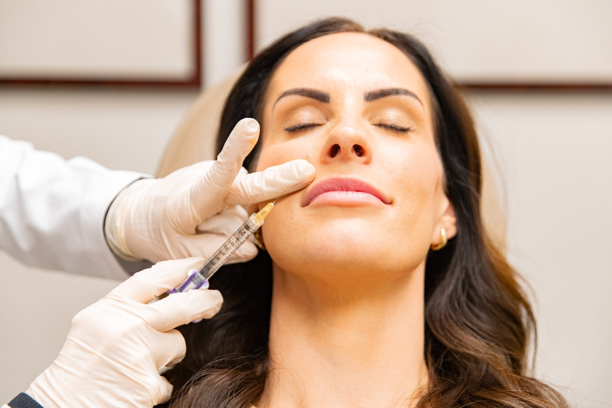 guide to lip filler