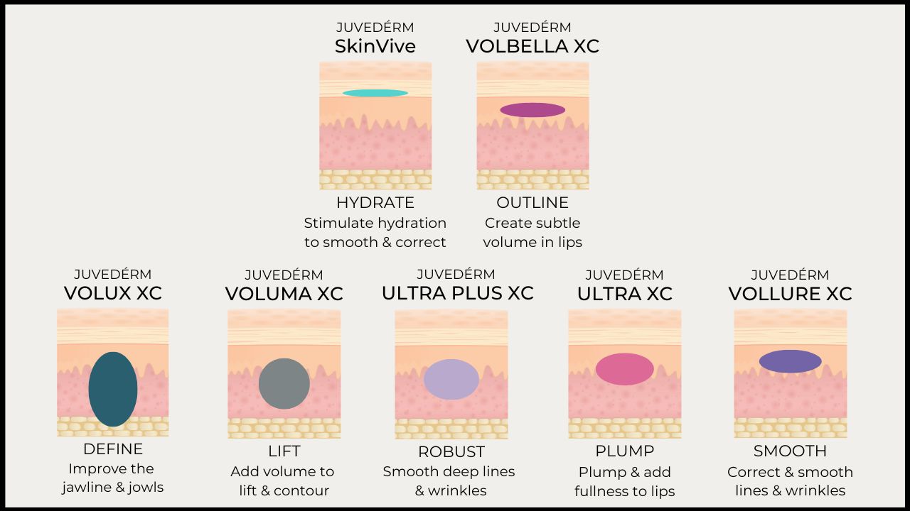 SkinVive: Microdroplet Dermal Filler