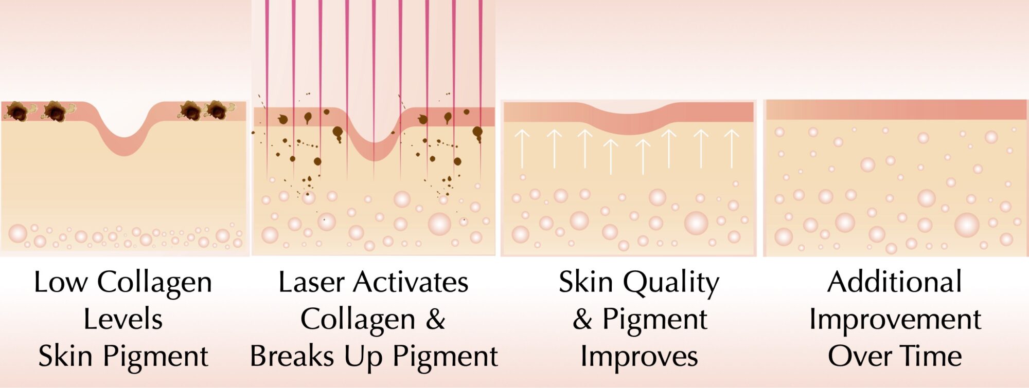 Tri-Beam_Laser_Treatment Tri-Beam_Laser_Treatment