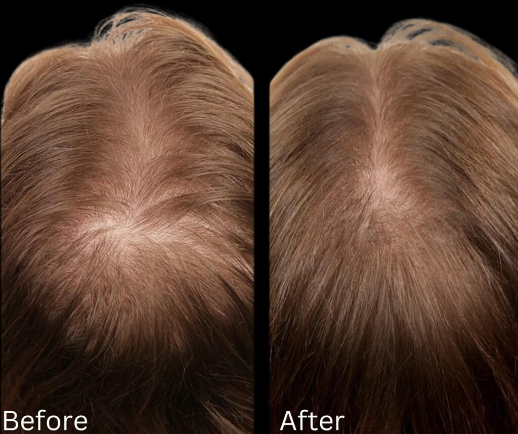 Hair growth & Health