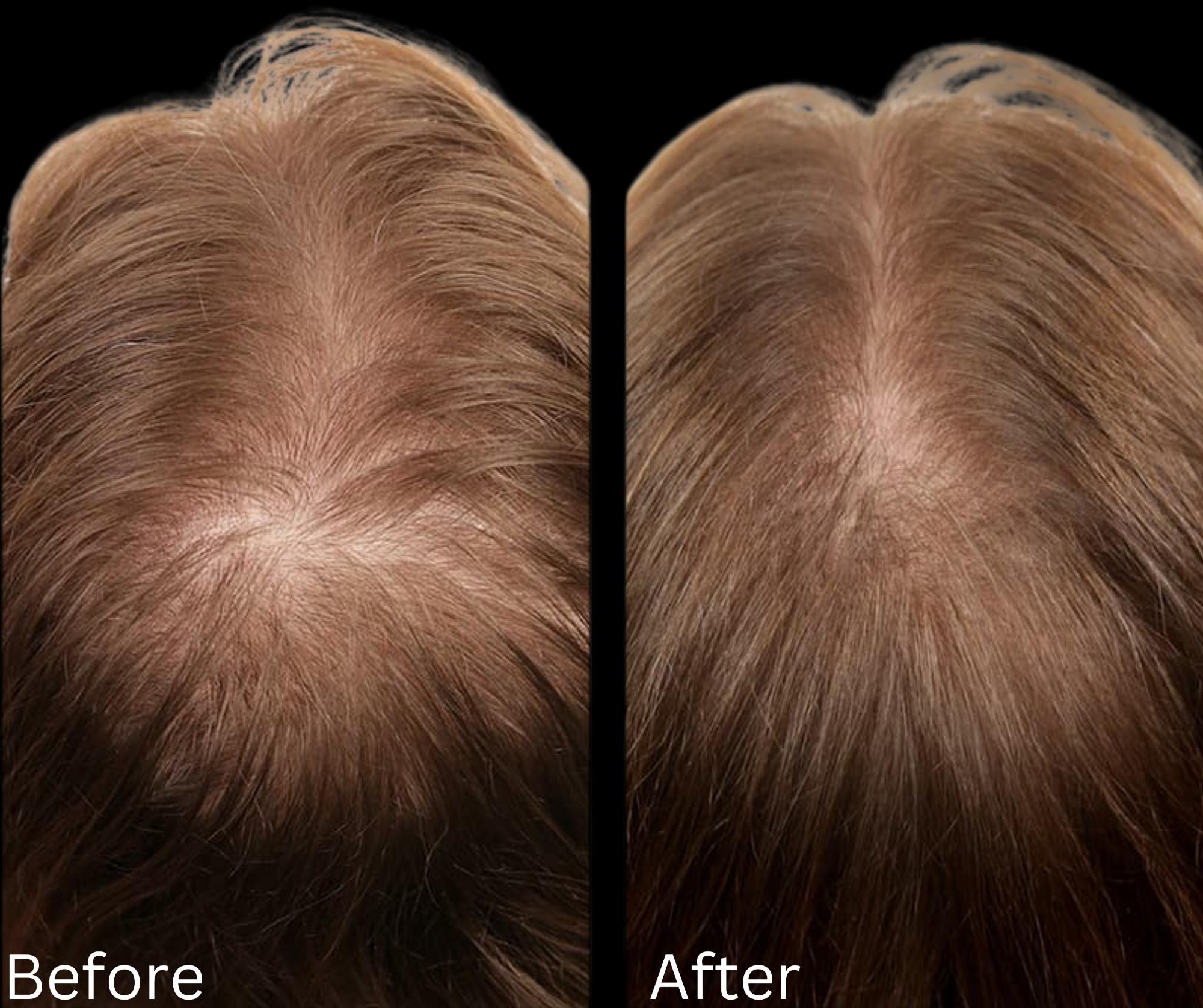 Hair growth & Health