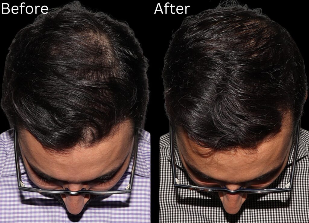 Hair growth & Health