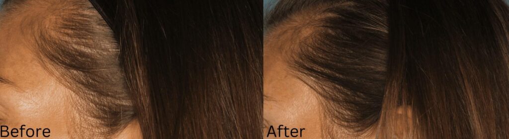Hair growth & Health