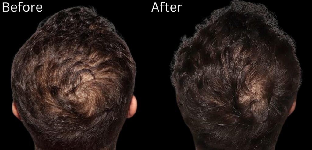 Hair growth & Health