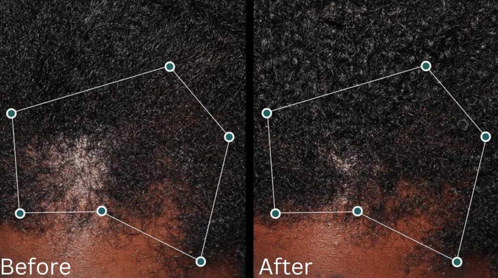 Hair growth & Health