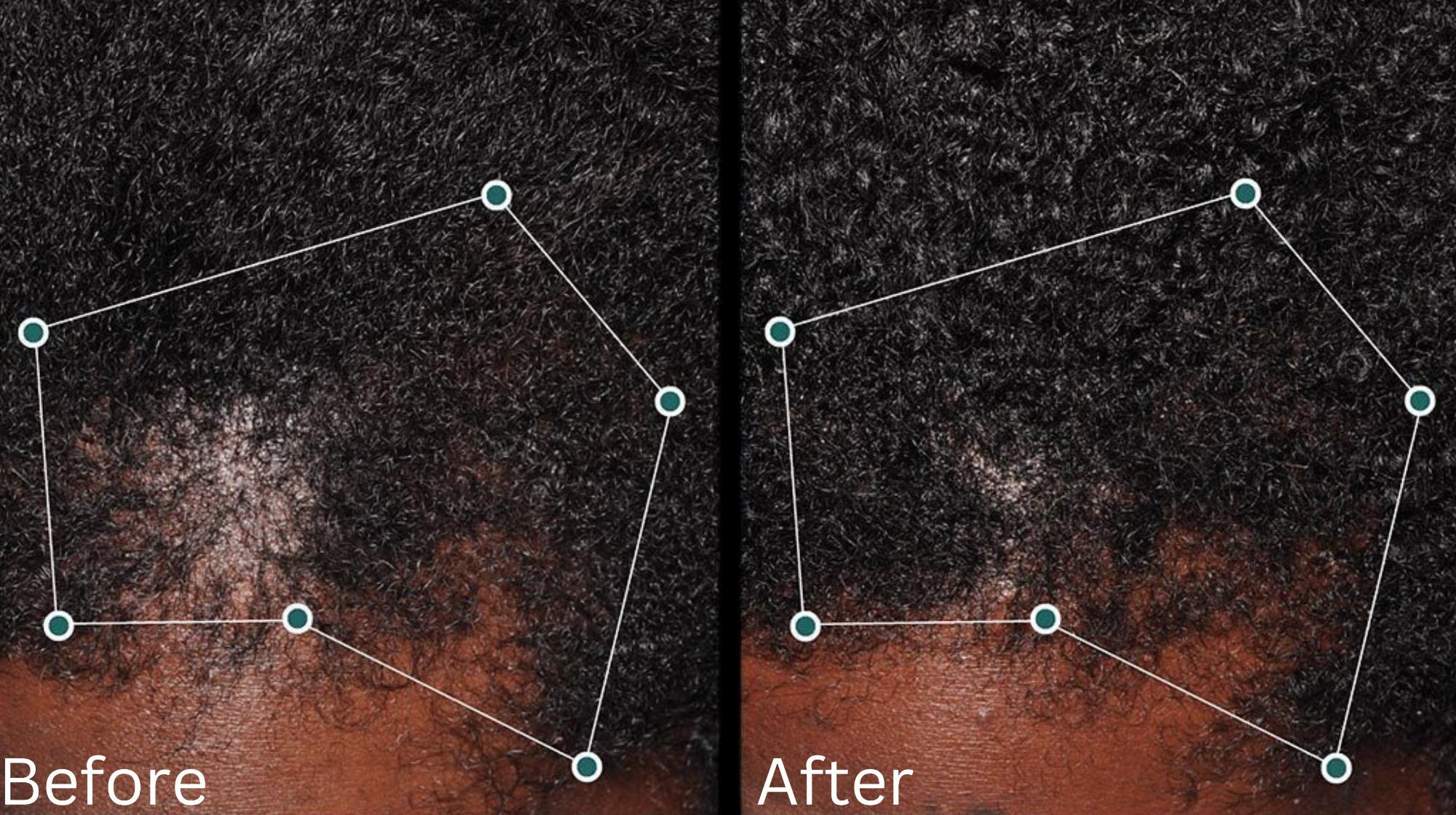 Hair growth & Health