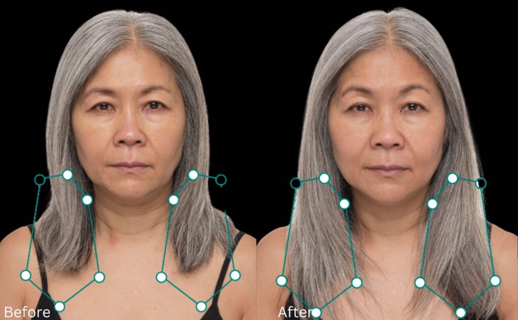 Hair growth & Health