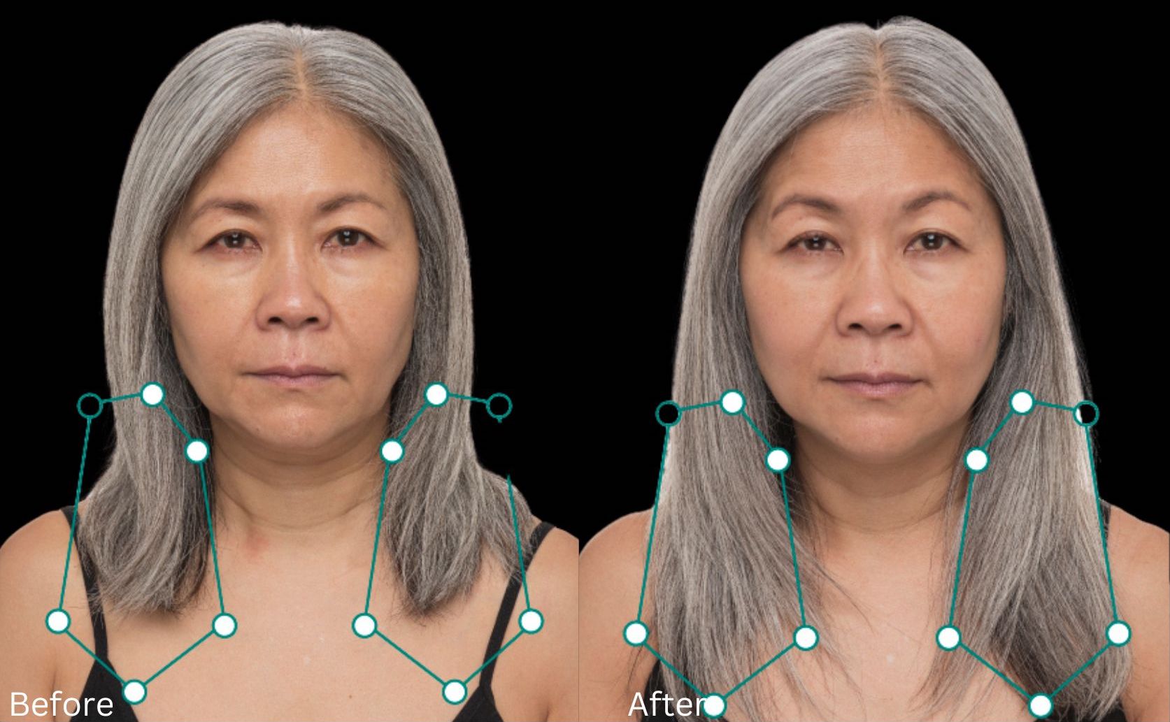 Hair growth & Health