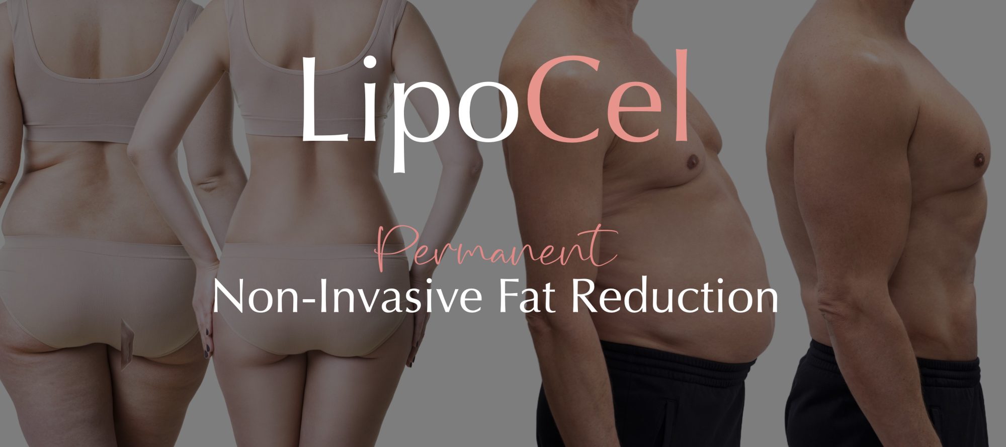 LipoCel DrChernoff SantaRosa LipoCel DrChernoff SantaRosa