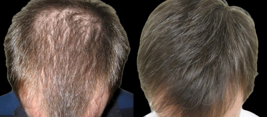 GGC Untitled design (1)