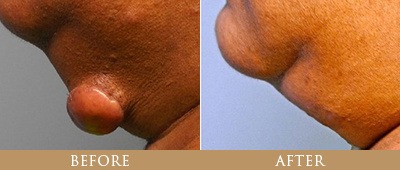 Dr. Gregory Chernoff Before and After