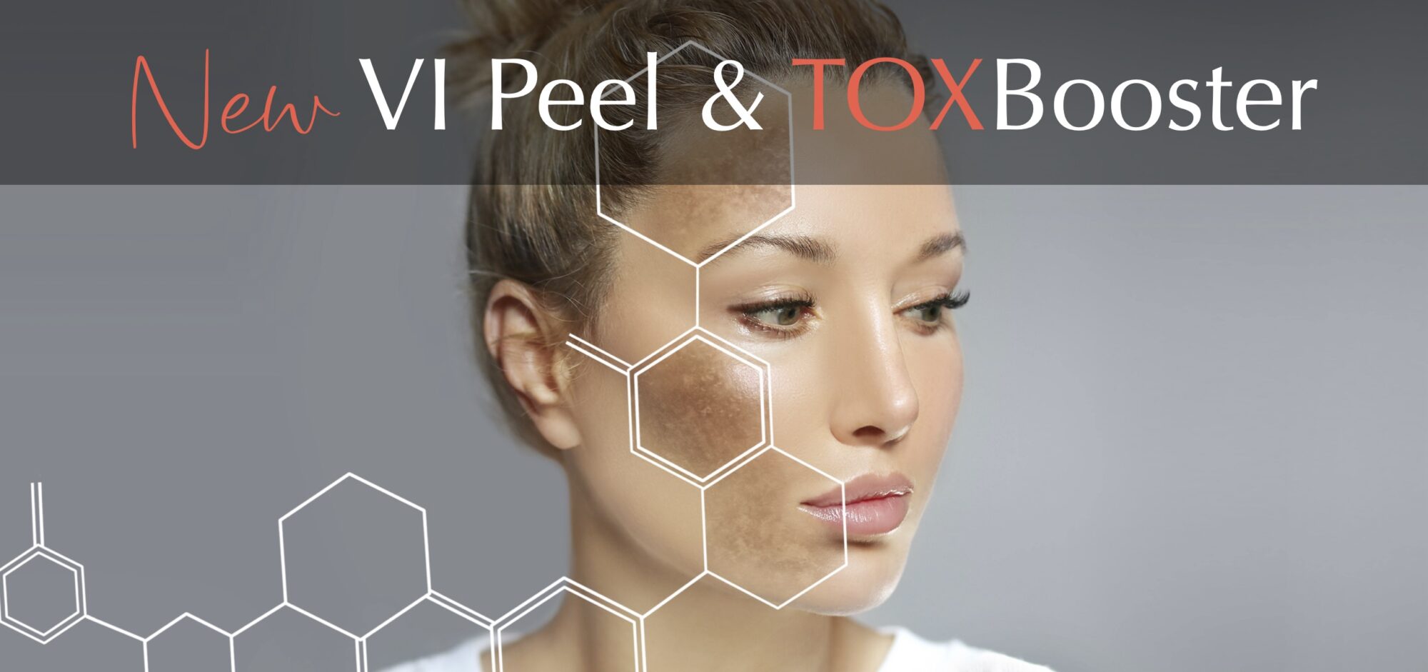 VI Peel at Chernoff Cosmetic Surgery