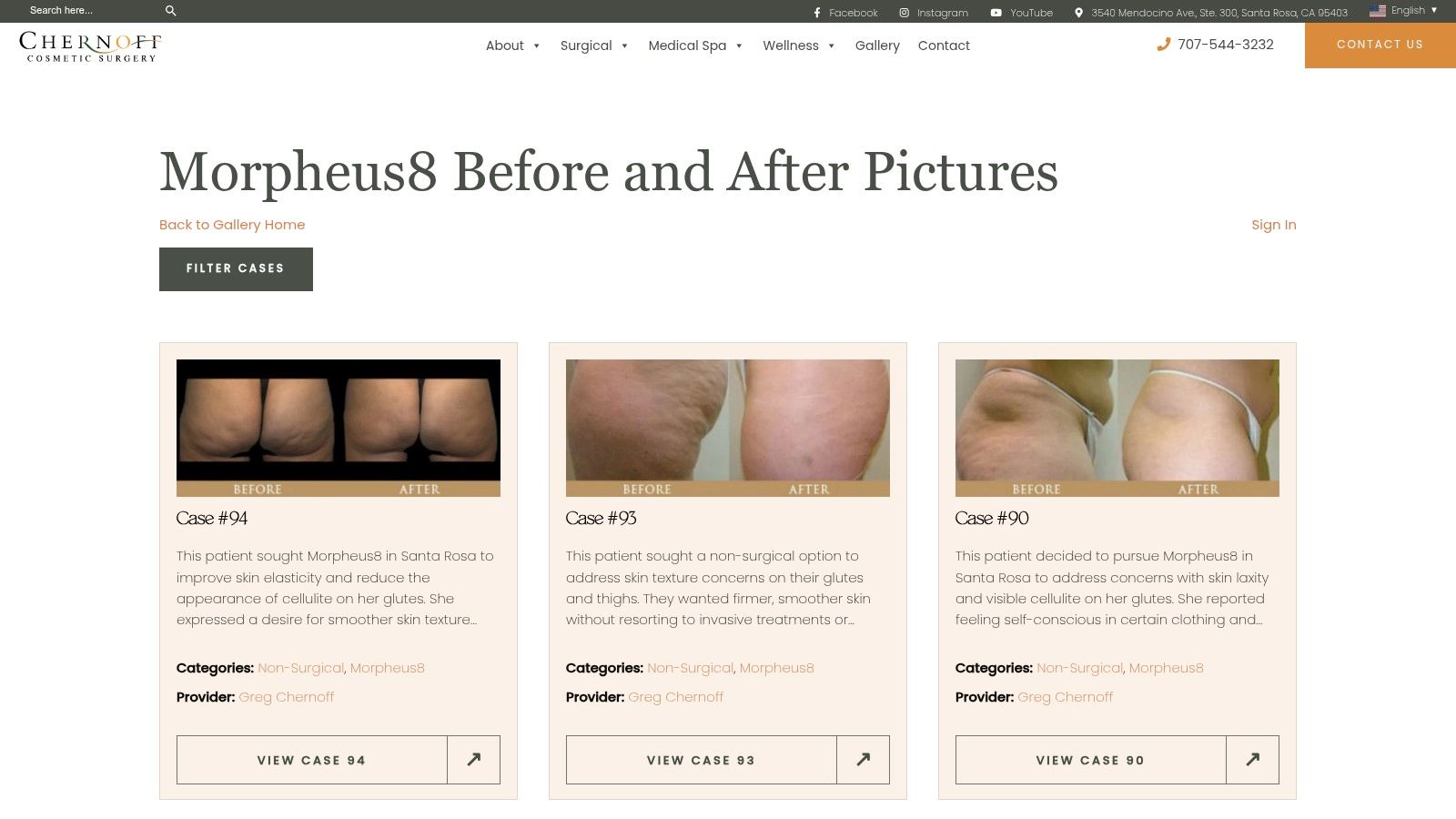 Morpheus8 Before and After Pictures