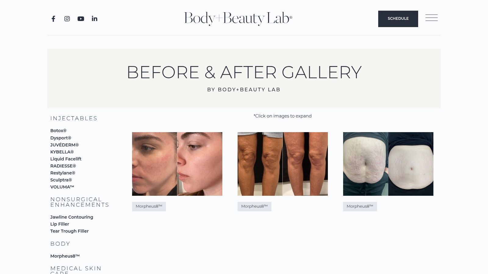 Body+Beauty Lab (Philadelphia, PA) &ndash; Morpheus8 Gallery