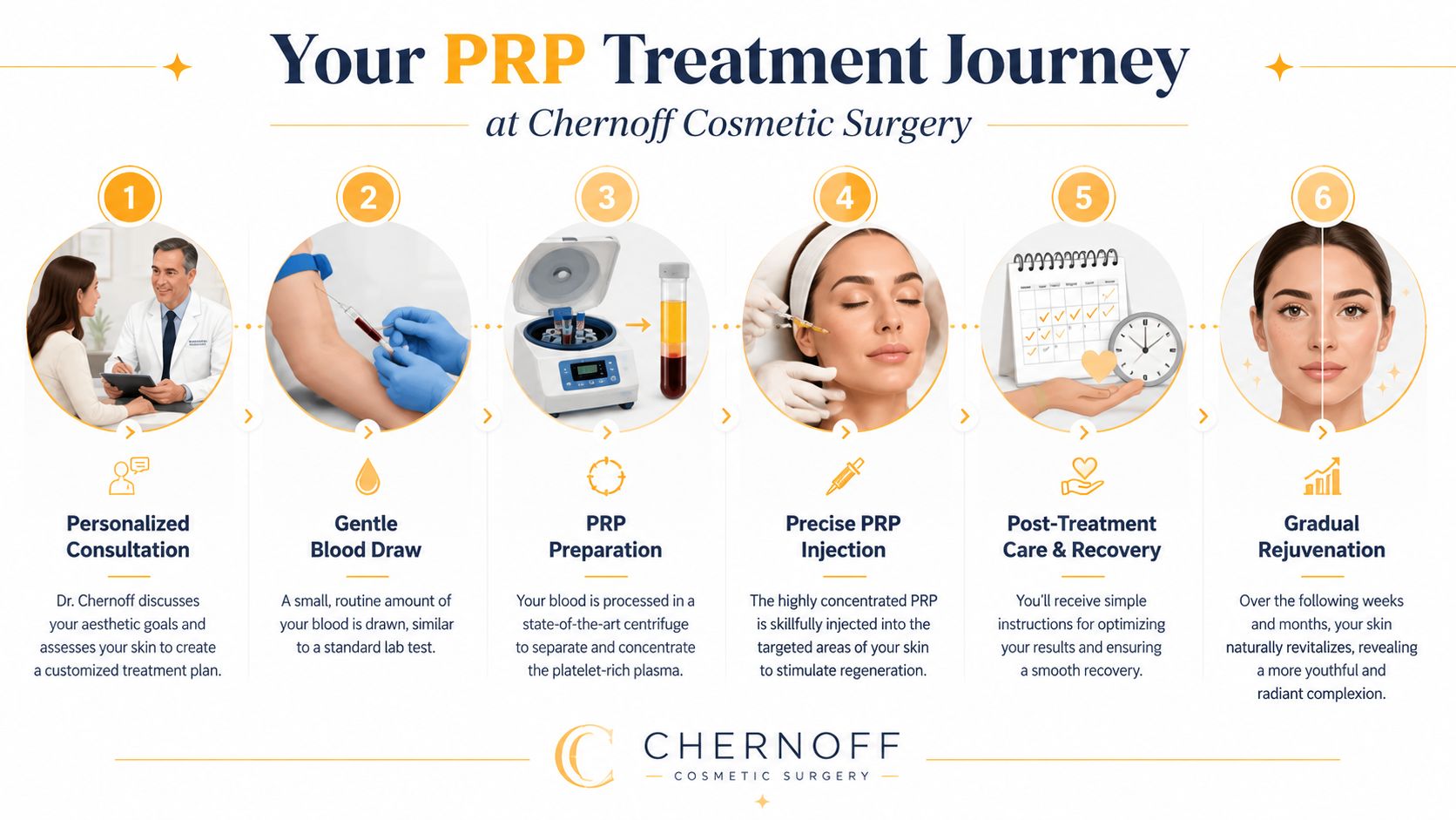 A six-step infographic detailing the PRP treatment journey at Chernoff Cosmetic Surgery, from consultation to skin rejuvenation.
