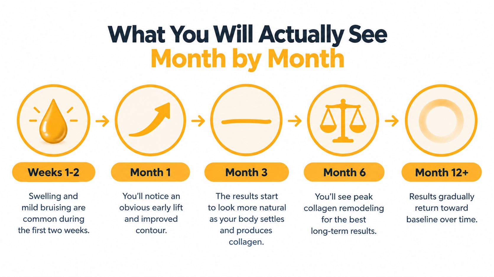 A timeline graphic showing the expected month-by-month results and recovery process following a PDO thread lift procedure.